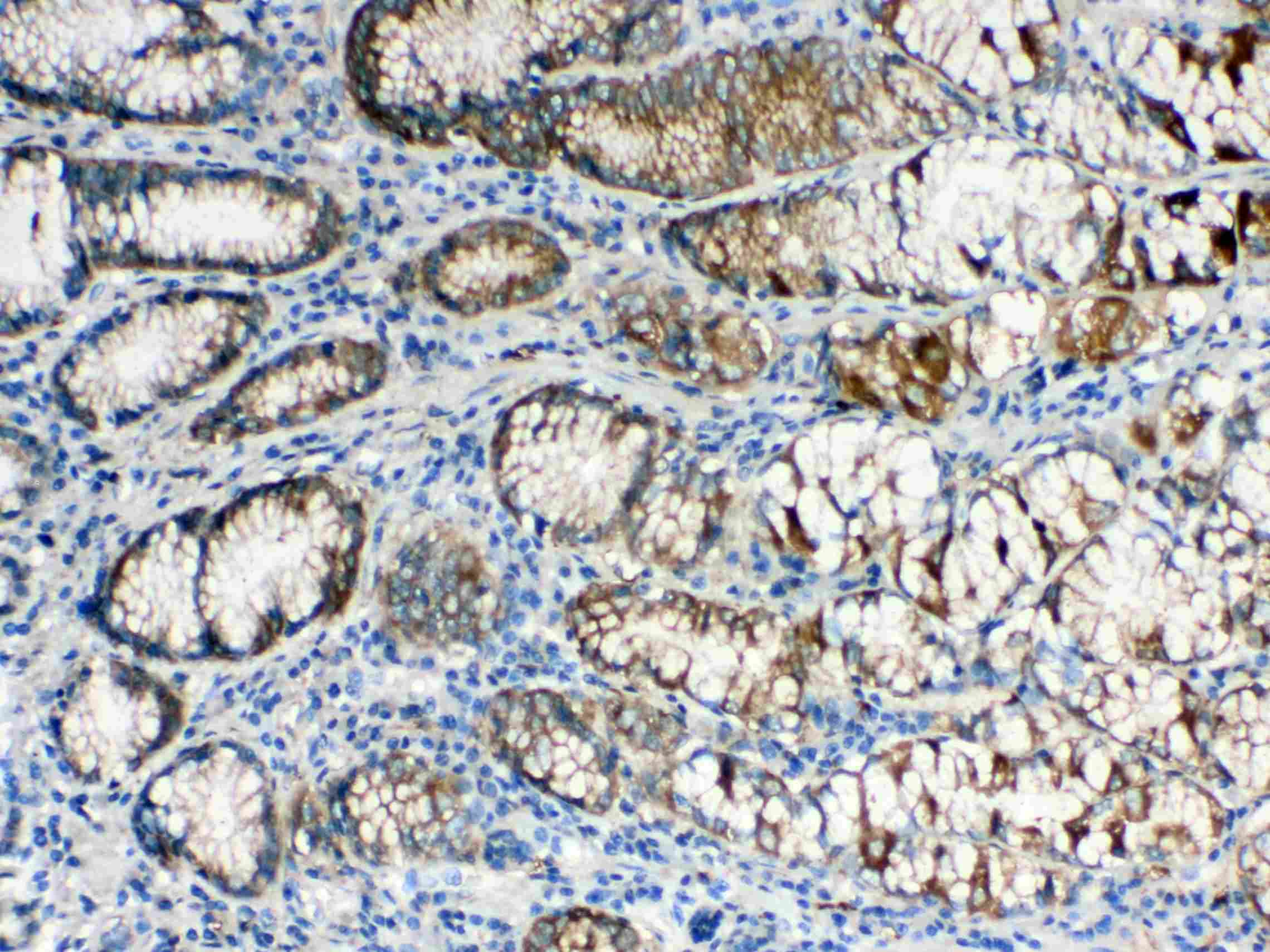 ALDH1A3 Antibody