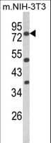 IHC-plus™ PRKCA / PKC-Alpha Antibody (aa75-103)