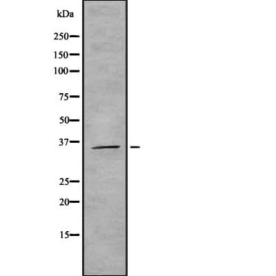 HNRNPAB Antibody