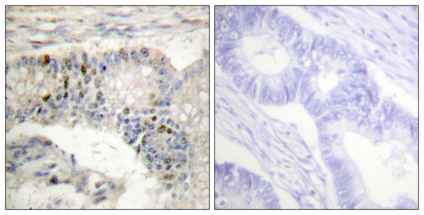 Histone H1 Antibody (p17)