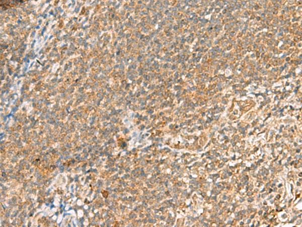 Polyclonal Rabbit anti-Human SCRN2 / Ses2 Antibody (IHC, WB)
