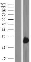 VPS29 Protein (Over-Expression Lysate Myc-DDK (Flag))