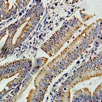 Polyclonal Rabbit anti-Human PIBF1 / PIBF Antibody (IHC, WB)