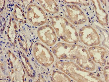 ACAD11 Antibody