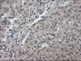 Monoclonal Mouse anti-Human BUB1B / BubR1 Antibody (clone OTI10B7, IHC, IF, WB)