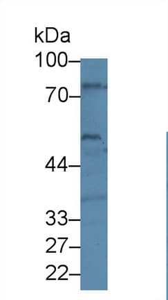 BEST1 / BEST / Bestrophin Antibody