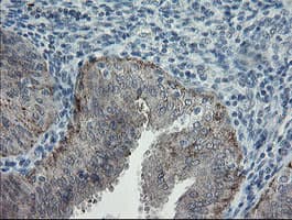 APP / Beta Amyloid Precursor Antibody (clone OTI6F11, Carrier-free)
