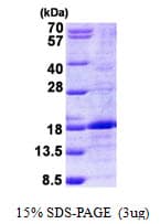 Human BMP6 Protein (Recombinant His)