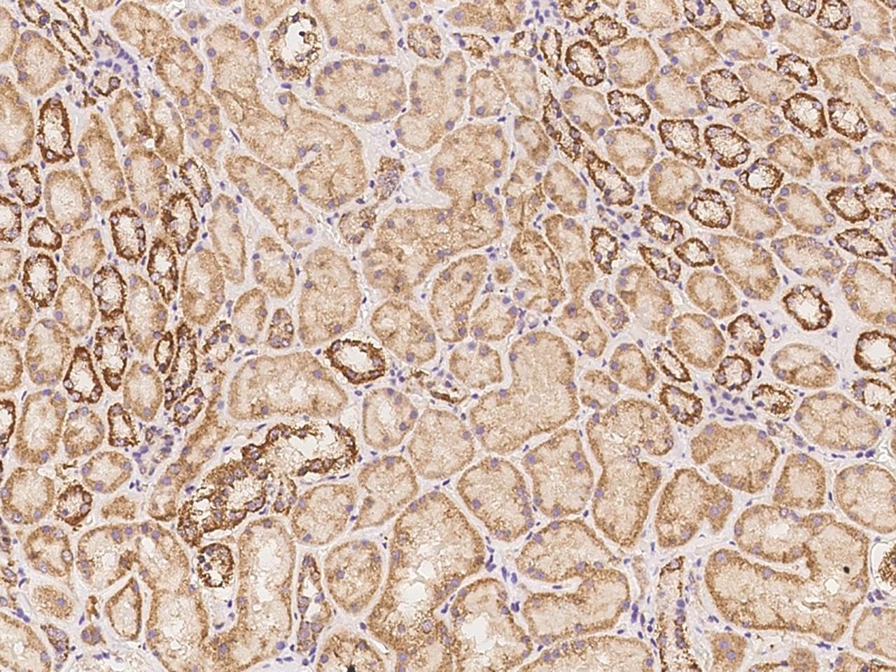 TBC1D14 Antibody