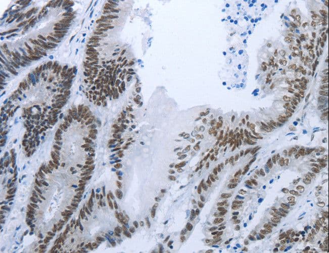 RBMS1 Antibody