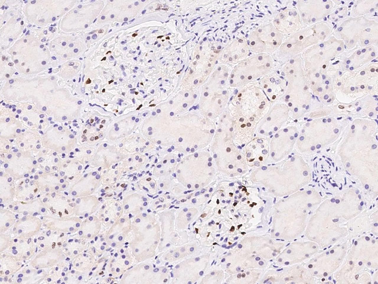 DACH / DACH1 Antibody