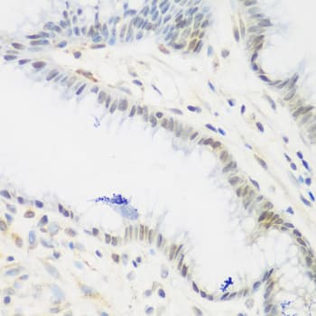 IMP-3 / IGF2BP3 Antibody