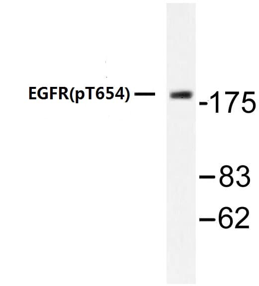 EGFR Antibody (Thr654)