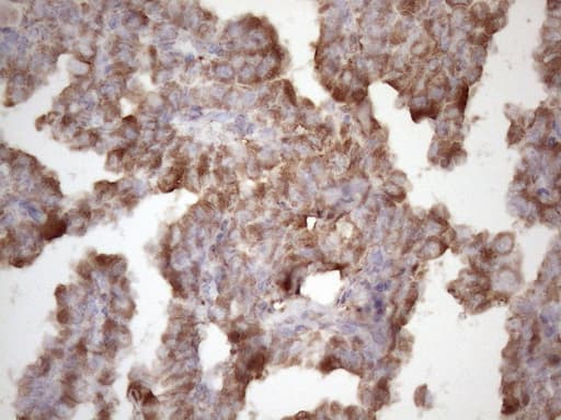 TNF Alpha Antibody (clone OTI5H8, Carrier-free)