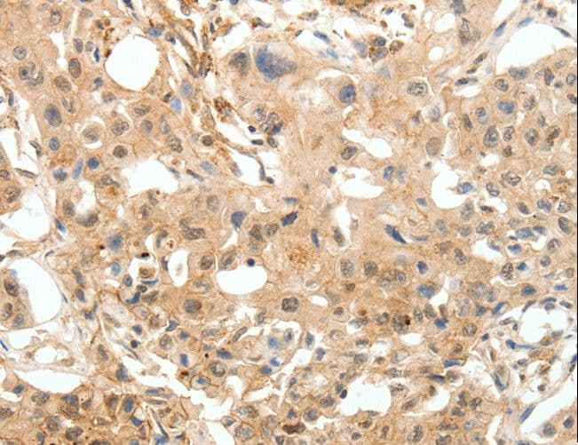COL4A1 / Collagen IV Alpha1 Antibody