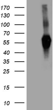 Monoclonal Mouse anti-Human SIRPB1 / CD172b Antibody (clone OTI3G8, aa30-398, WB)