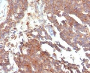 GnRH receptor / GNRHR Antibody (clone LCHR37)