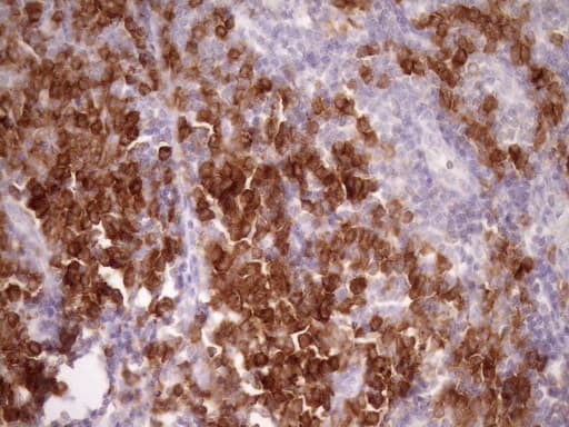 Monoclonal Mouse anti-Human SLAMF7 / CRACC Antibody (clone OTI3B3, IHC, WB)