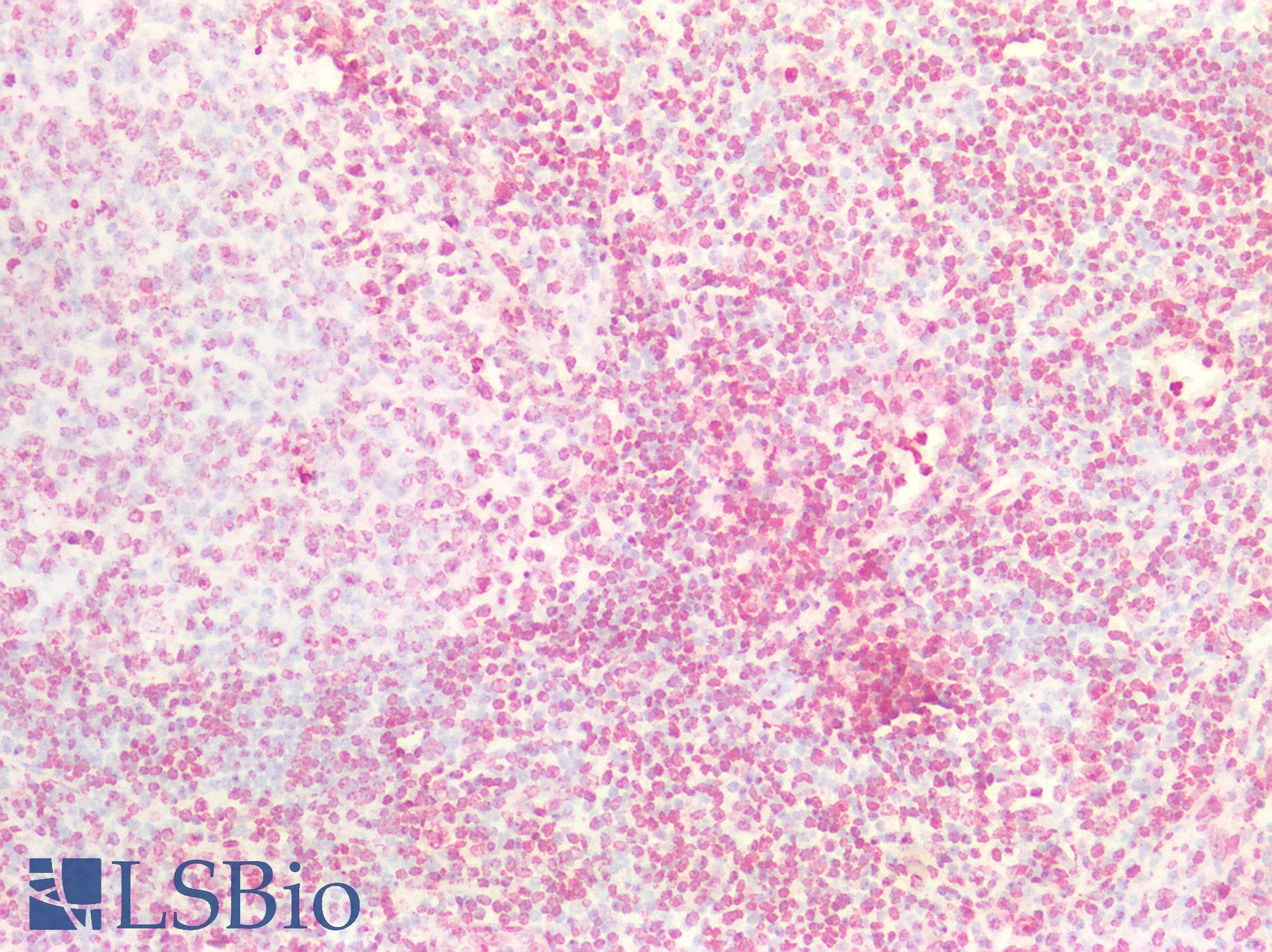 ARPC4 Antibody (N-Terminus)