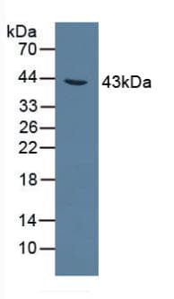 AGXT / SPT Antibody (aa182-371)
