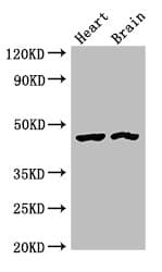 CTH / Cystathionase Antibody
