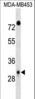 DAPP1 / BAM32 Antibody (aa247-275)