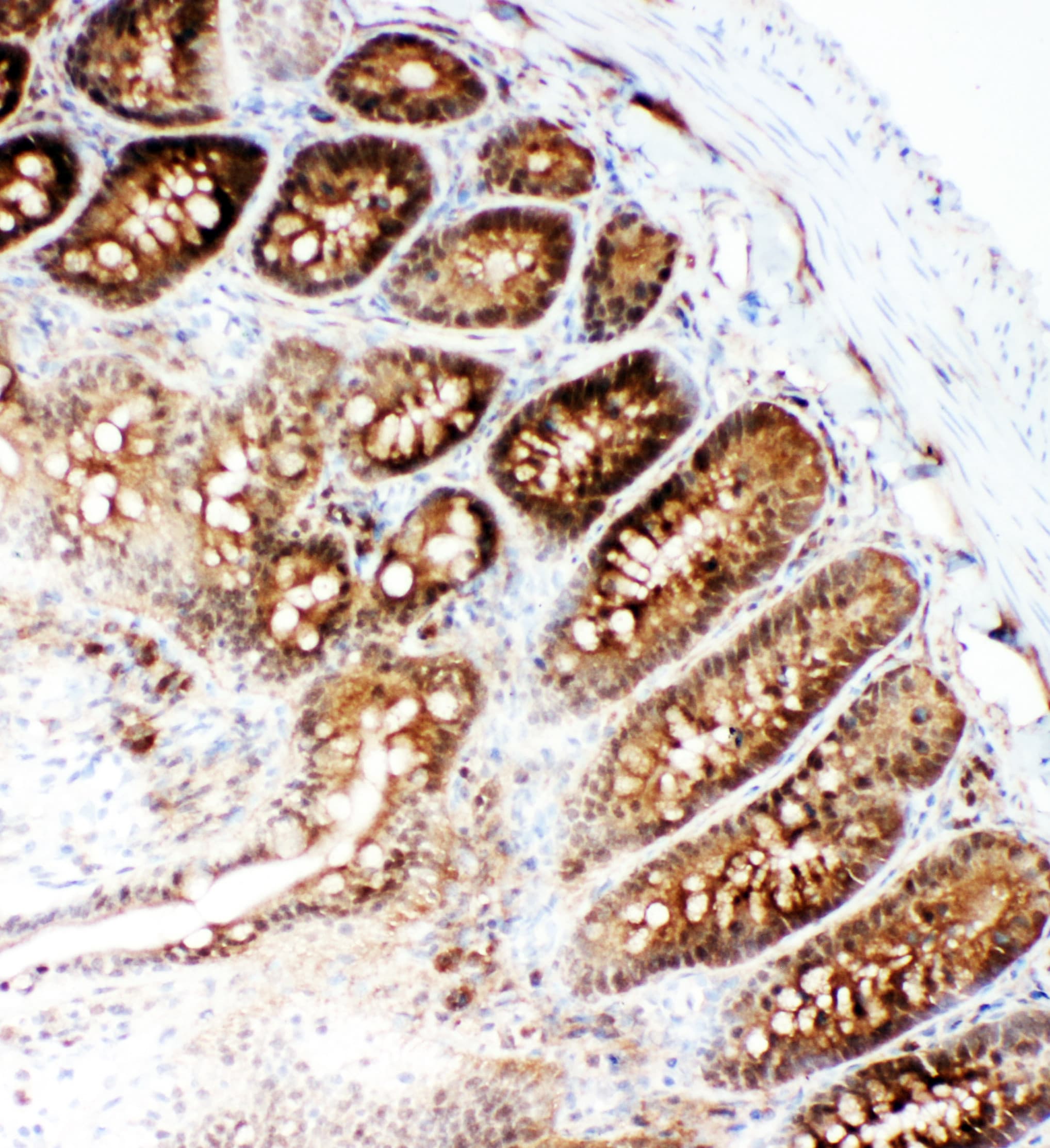 Polyclonal Rabbit anti-Human VCP Antibody (aa749-766, IHC, WB)