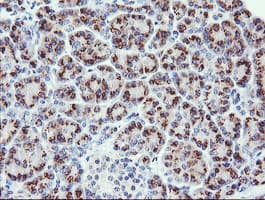 PIK3CG / PI3K Gamma Antibody (clone OTI4G10)