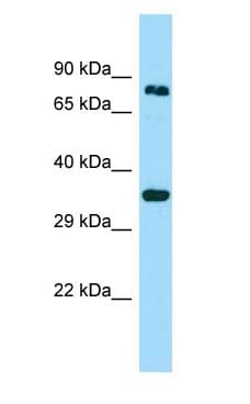 HOOK3 Antibody (aa497-546)