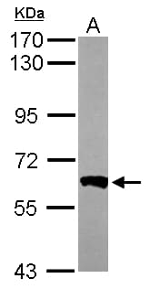IHC-plus™ Polyclonal Rabbit anti-Human PPP3CB Antibody (aa1-228, IHC, WB)