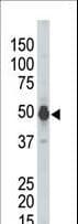 PHKG2 Antibody (aa41-71)