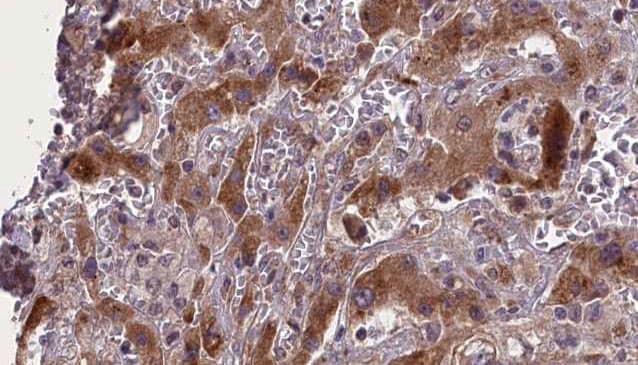 CD105 Antibody