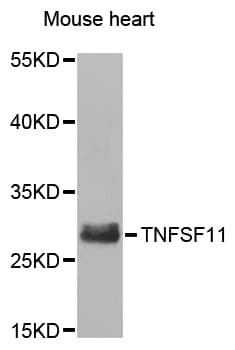 TNFSF11 / RANKL / TRANCE Antibody