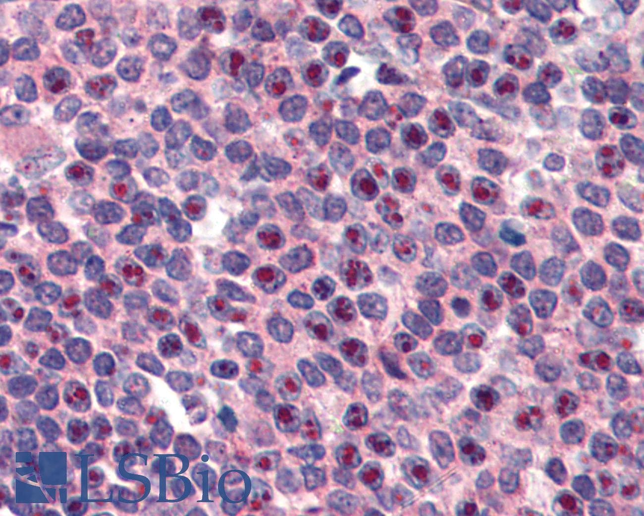 IHC-plus™ Polyclonal Goat anti-Human FANCG Antibody (aa609-622, IHC, WB)