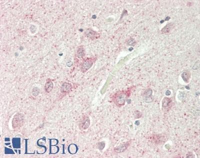 Polyclonal Rabbit anti-Human DNAM-1 / CD226 Antibody (aa225-274, IHC, WB)