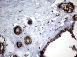 Monoclonal Mouse anti-Human CTNND1 / p120 Catenin Antibody (clone OTI3G1, IHC, WB)
