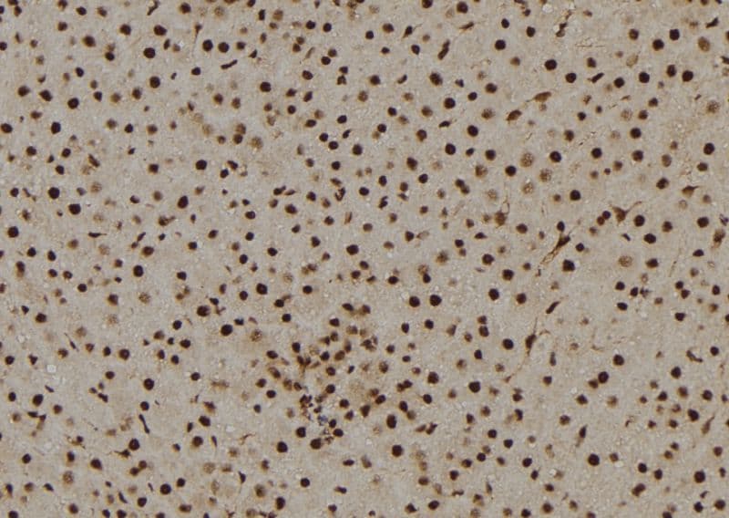 Polyclonal Rabbit anti-Human CCNB1 / Cyclin B1 Antibody (IHC, IF, WB)