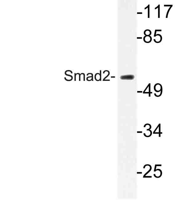 SMAD2 Antibody (Tyr216)