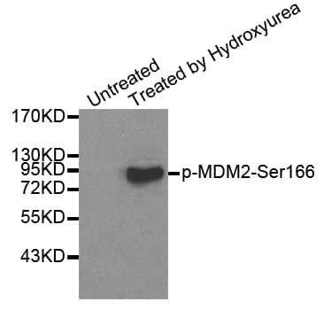 MDM2 Antibody (phospho-Ser166)