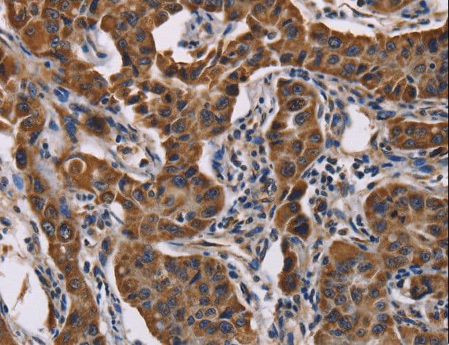 Polyclonal Rabbit anti-Human ADRBK2 / GRK3 Antibody (IHC)