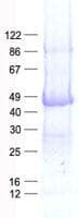 Human DHH / Desert Hedgehog Protein (Recombinant His, N-Terminal)