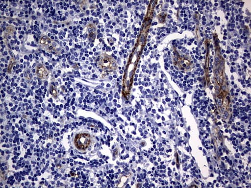 Monoclonal Mouse anti-Human MCAM / CD146 Antibody (clone OTI2G10, IHC, WB)
