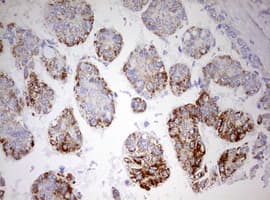 HADH Antibody (aa57-314, clone OTI1D4)