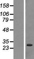 NANOS3 / NOS-3 Protein (Over-Expression Lysate Myc-DDK (Flag))