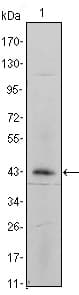 IHC-plus™ Monoclonal Mouse anti-Human ITGA5/Integrin Alpha 5/CD49e Antibody (clone 10F6, IHC, WB)