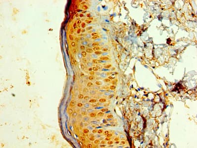 KRT6A / CK6A / Cytokeratin 6A Antibody (aa2-564)