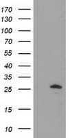 Monoclonal Mouse anti-Human AK3 / Adenylate Kinase 3 Antibody (clone OTI6G4, IHC, WB)