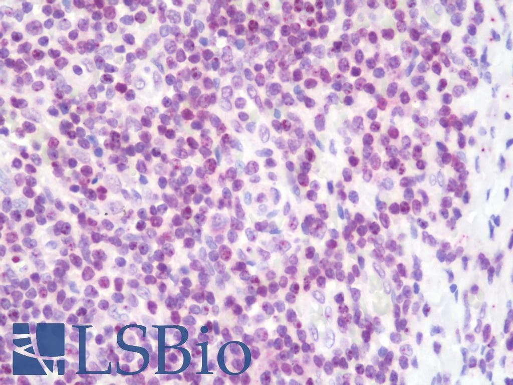 IHC-plus™ Polyclonal Rabbit anti-Human TNPO1 / Transportin 1 Antibody (aa47-74, IHC, WB)