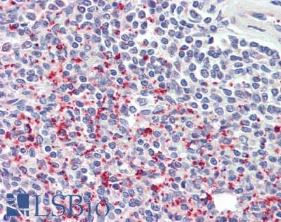 IHC-plus™ Polyclonal Rabbit anti-Human TREML1 / TLT1 Antibody (IHC)