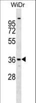 ANXA9 Antibody (aa208-235)